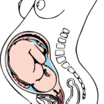 pregnancy back pain